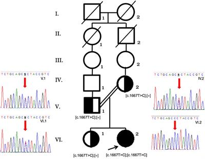Importance of genetic sequencing studies in managing chronic neonatal diarrhea: a case report of a novel variant in the glucose–galactose transporter SLC5A1